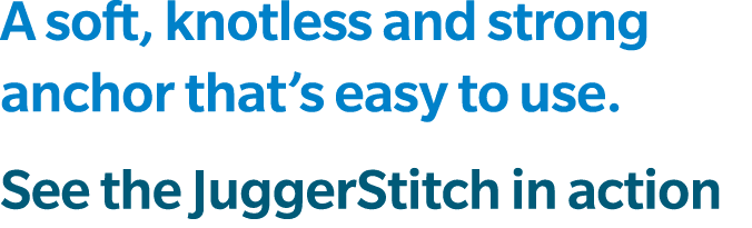 A soft, knotless and strong anchor that’s easy to use. See the JuggerStitch in action