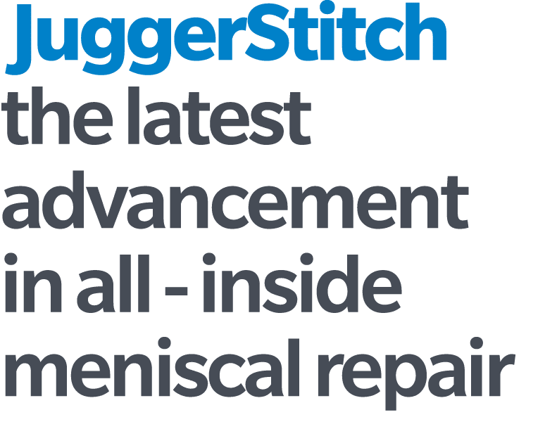  JuggerStitch the latest advancement in all inside meniscal repair