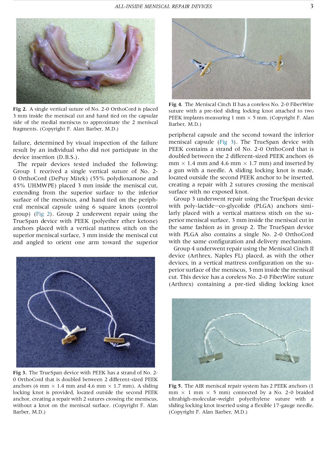 Arthroscopy: The Journal of Arthroscopic and Related Surgery, Corrected proof. doi:10.1016/j.arthro.2020.03.036