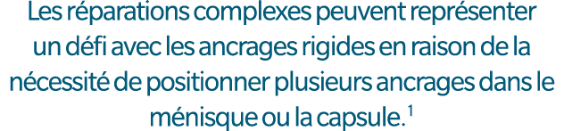 Les r parations complexes peuvent repr senter un d fi avec les ancrages rigides en raison de la n cessit de position...