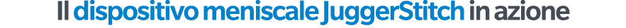 Il dispositivo meniscale JuggerStitch in azione