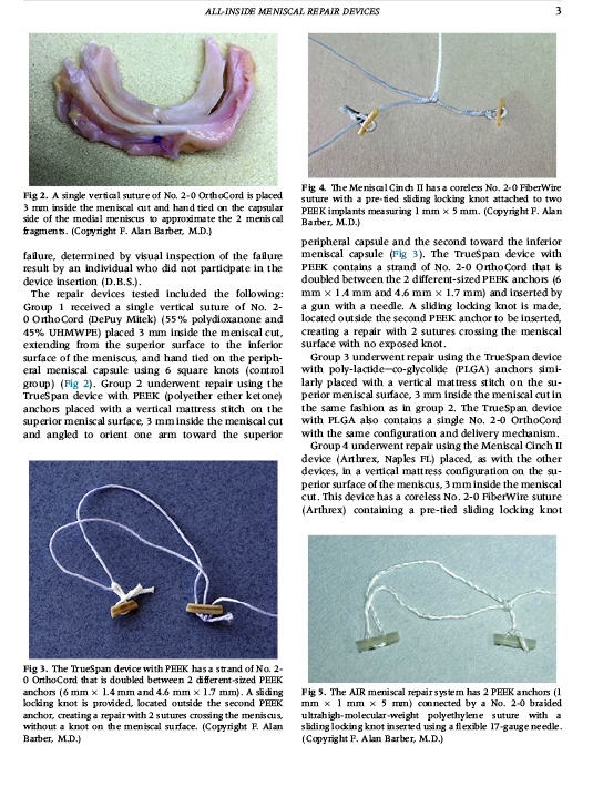Arthroscopy: The Journal of Arthroscopic and Related Surgery, Corrected proof. doi:10.1016/j.arthro.2020.03.036
