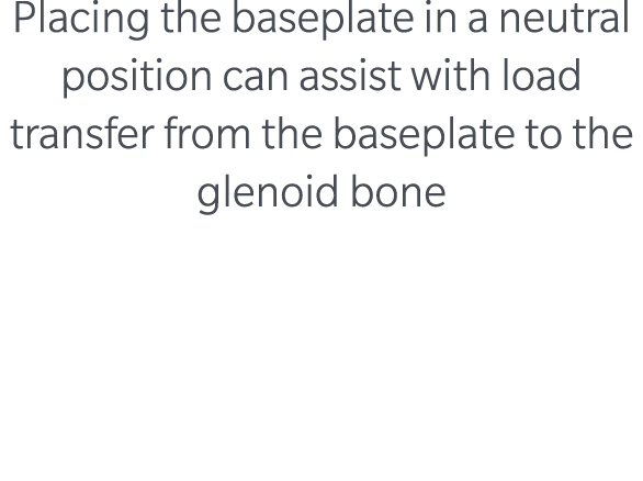 Placing the baseplate in a neutral position can assist with load transfer from the baseplate to the glenoid bone 